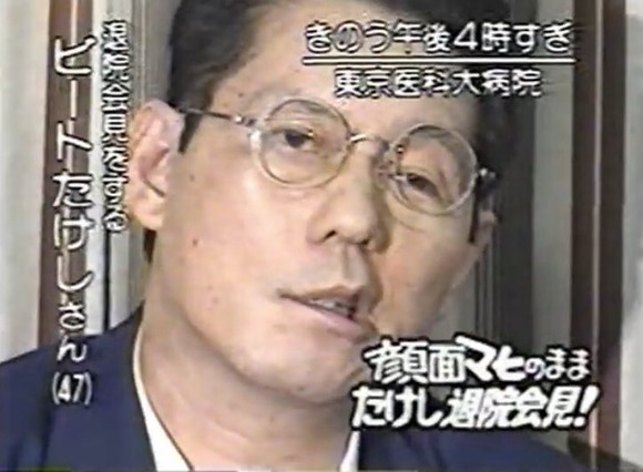 【衝撃】警察「息子のビートたけしさんが事故に合いました」たけし母「…」→母が口に出した言葉とは！？